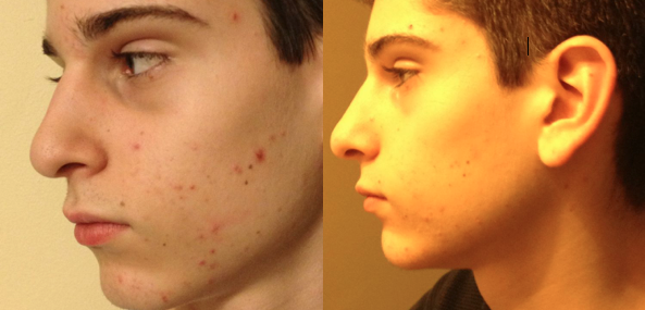 Beauty Product Review to Treat Oily Skin