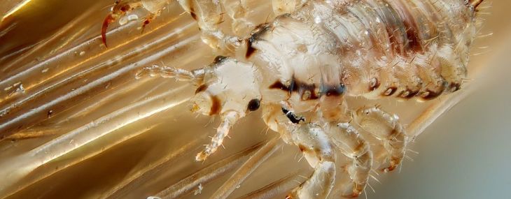 Head Lice Prevention and Treatment Tips