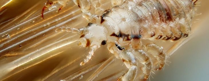 Head Lice Prevention and Treatment Tips