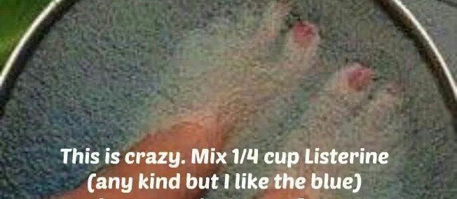 DIY Spa Pedicure With Listerine